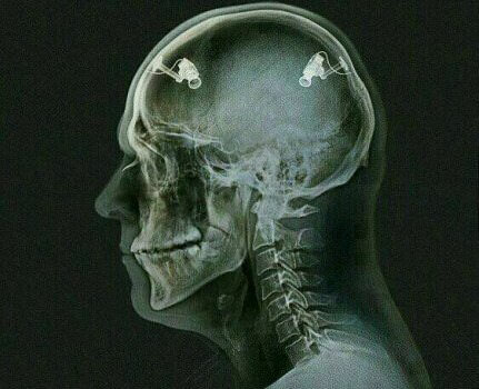 Think While It's Legal Meme